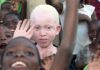 Ser albino: En África puede llevar a la muerte, en Europa y América, una estrella de la moda